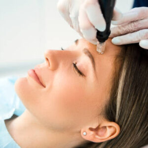 Level 5 Principles and Practice of Microneedling Treatments