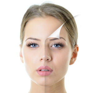 Level 5 Principles and Practice of Chemical Peel Treatments
