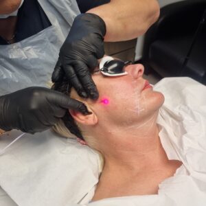 Level 5 Certificate in Endolaser Treatments