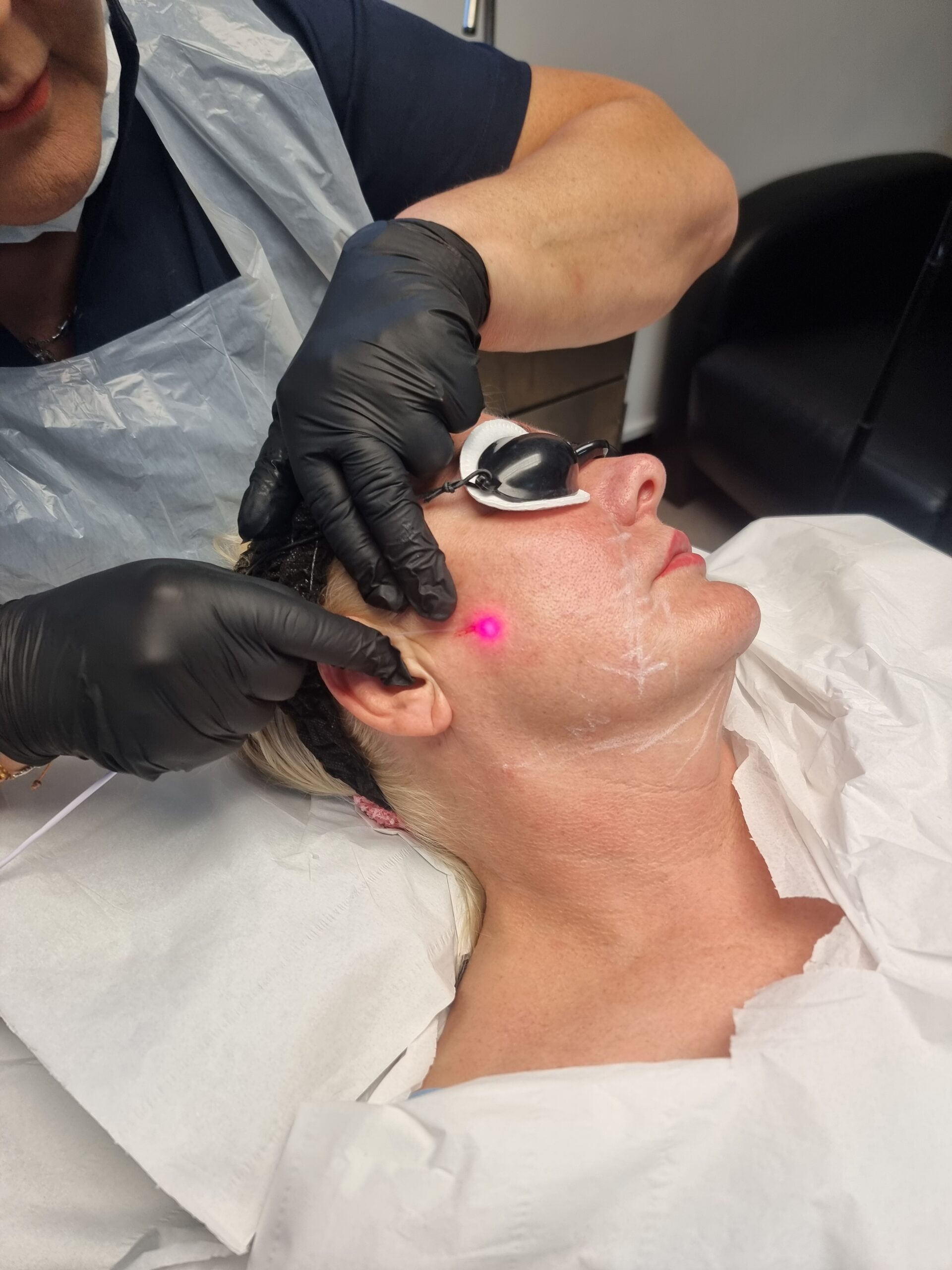 Level 5 Certificate in Endolaser Treatments