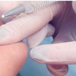 Level 7 Aesthetic Injectable Therapies for Facial Treatments with Temporary Dermal Fillers